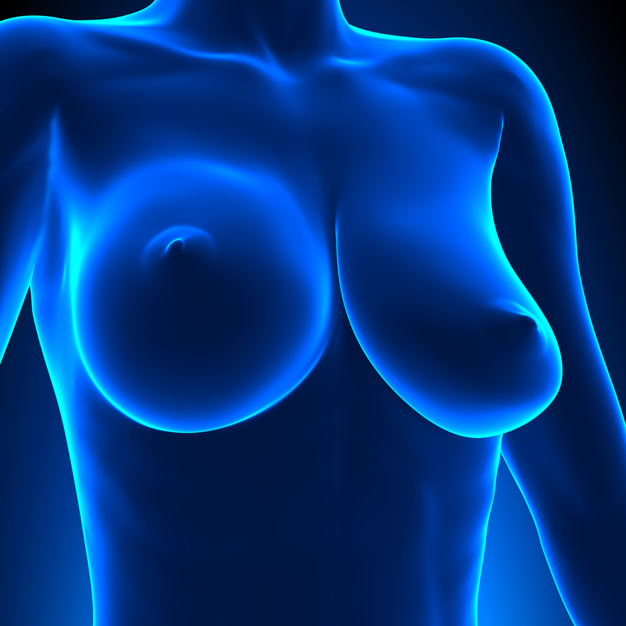 https://www.drpfeifer.com/blog/wp-content/uploads/2023/03/tuberous-breasts.jpeg