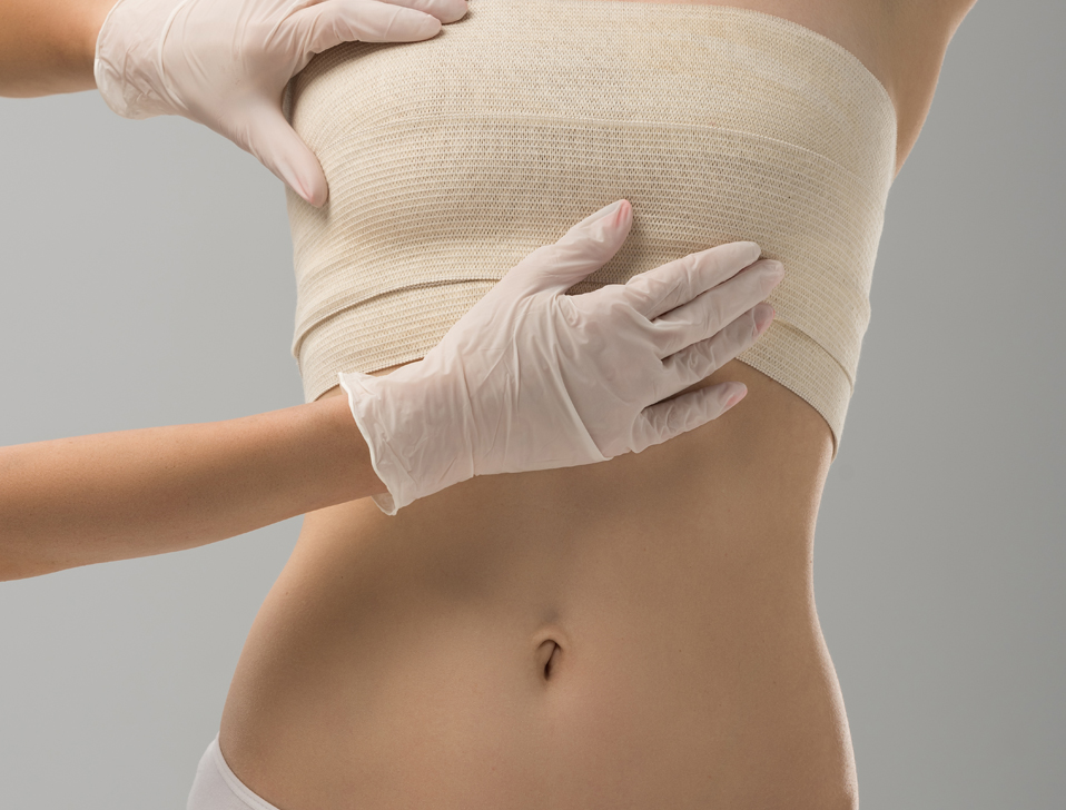 breast augmentation